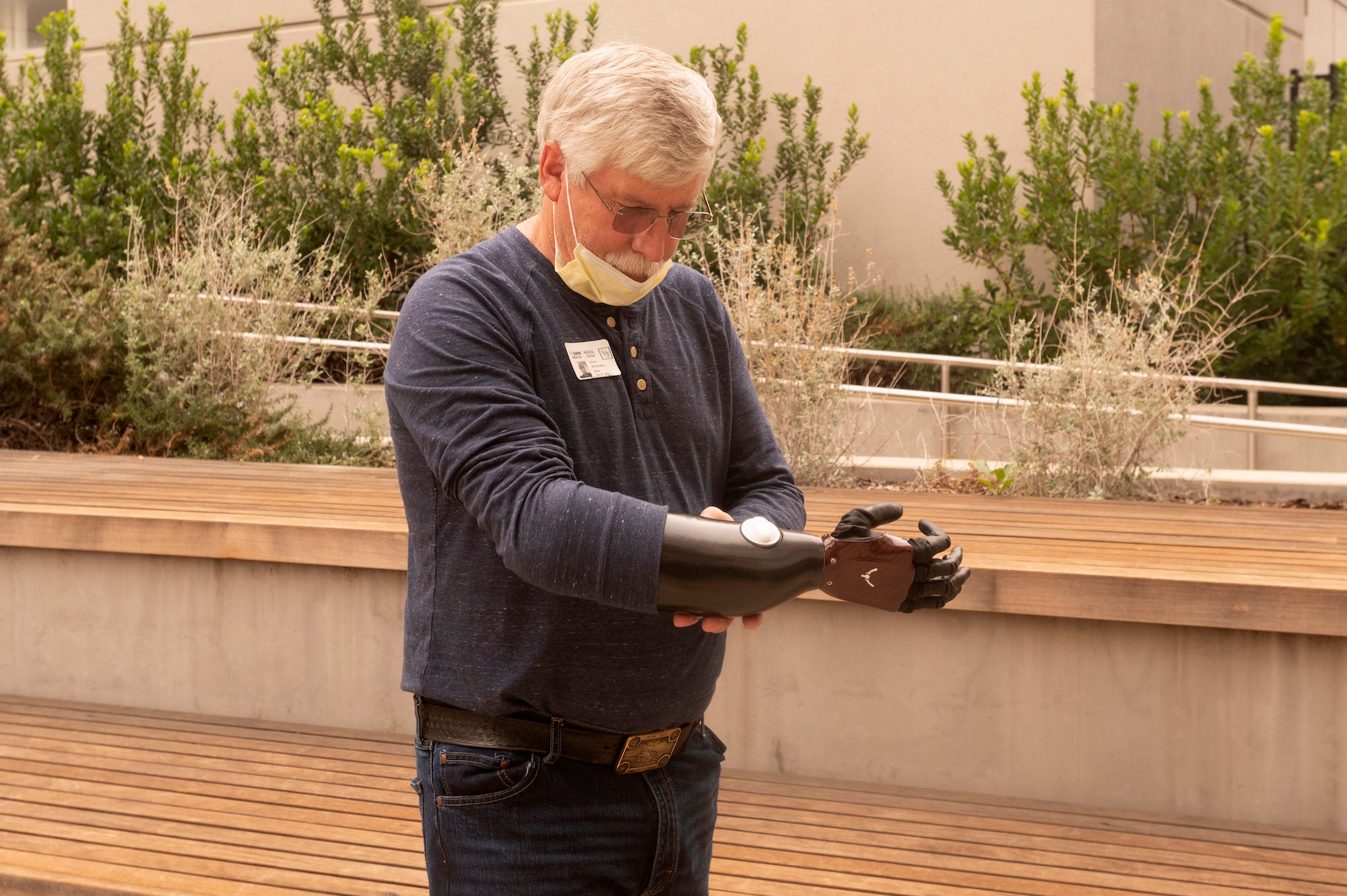 David Brockman, a retired firefighter and hand amputee, shows off his new myoelectric prosthetic device.