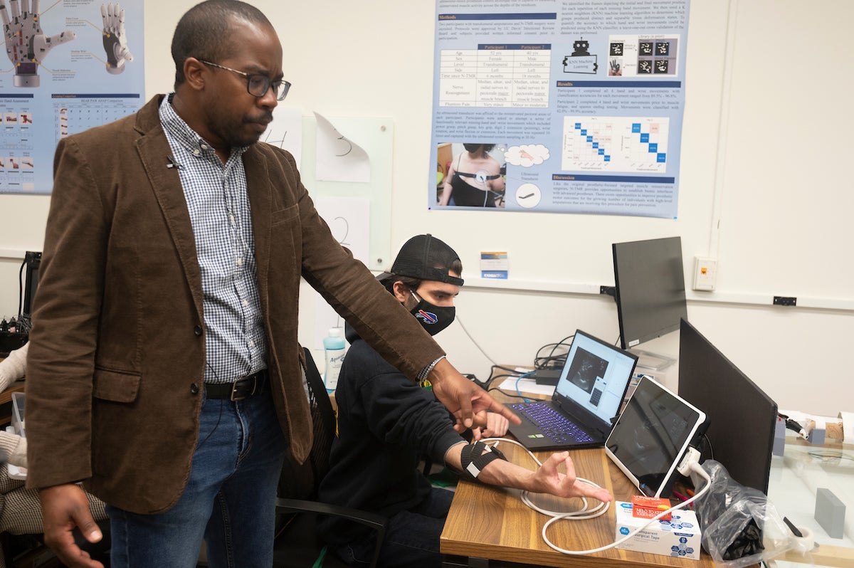 Neuroscientist Wilsaan Joiner points to an ultrasound machine. Scientists are using both ultrasound and electromyography, combined with AI, to make prosthetics easier to control. (Greg Urquiaga/UC Davis)