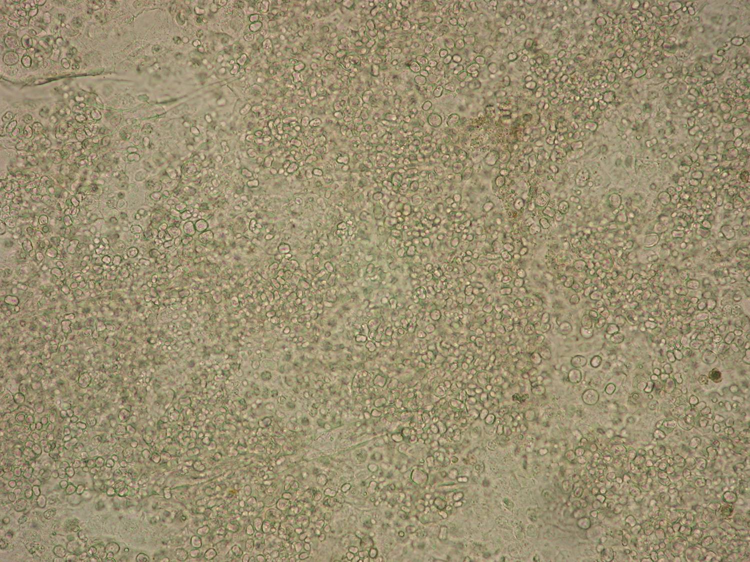 beige, microscopic view of frog skin infected with Bd pathogen