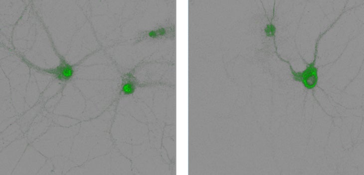 Two adjacent panels show green dots over grey cells. 