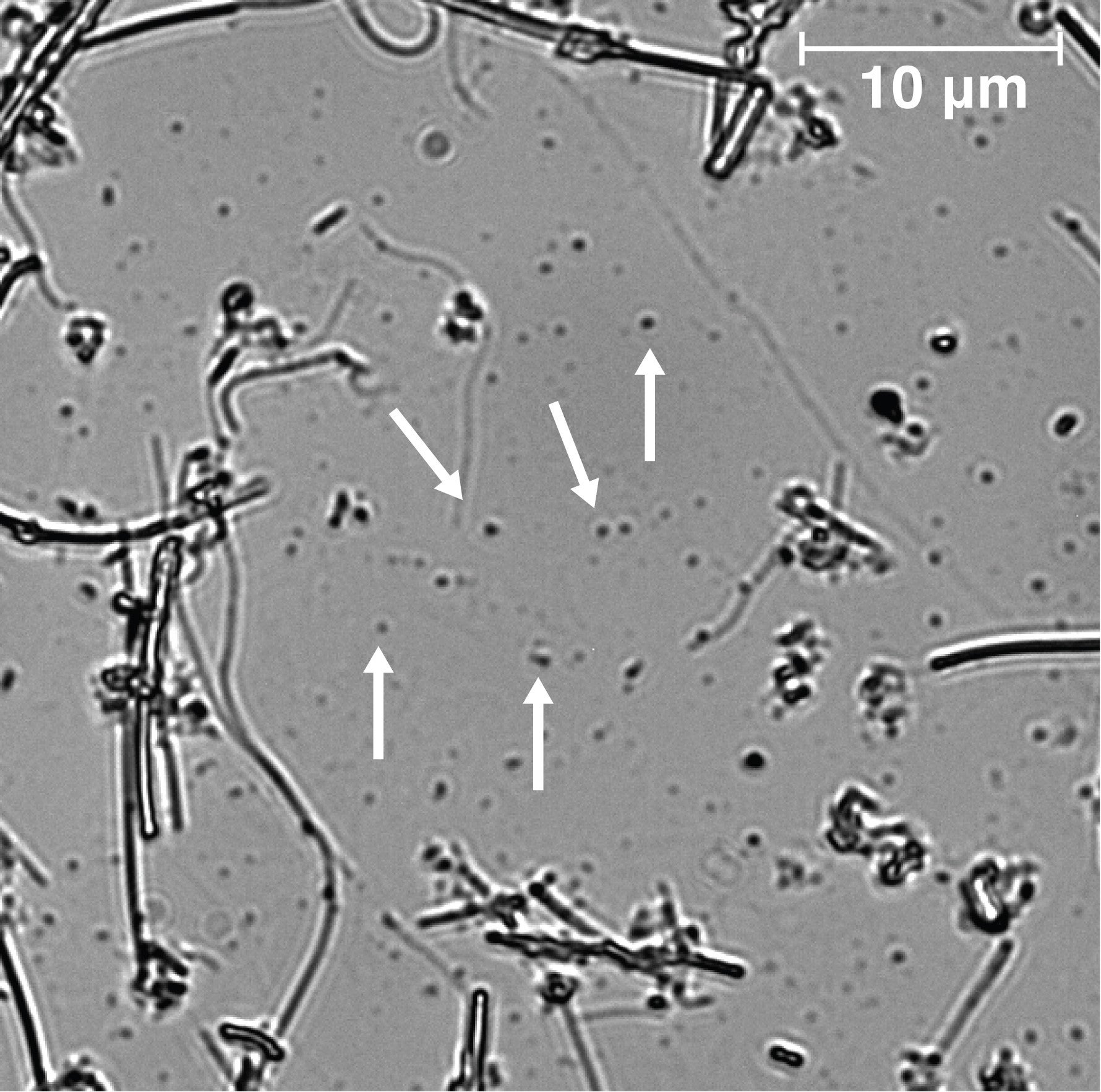 Grayscale micrograph of circular nanoplastics with scattered rods and six white arrows; 10 &micro;m scale.