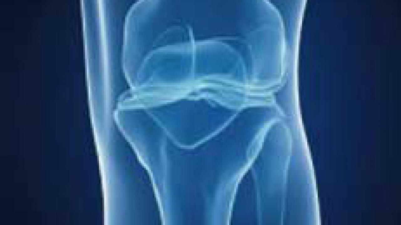 X-ray of knee