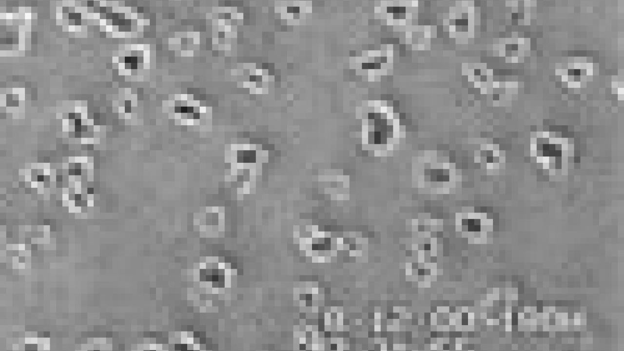 Photo: amoeba photographed under a microscope