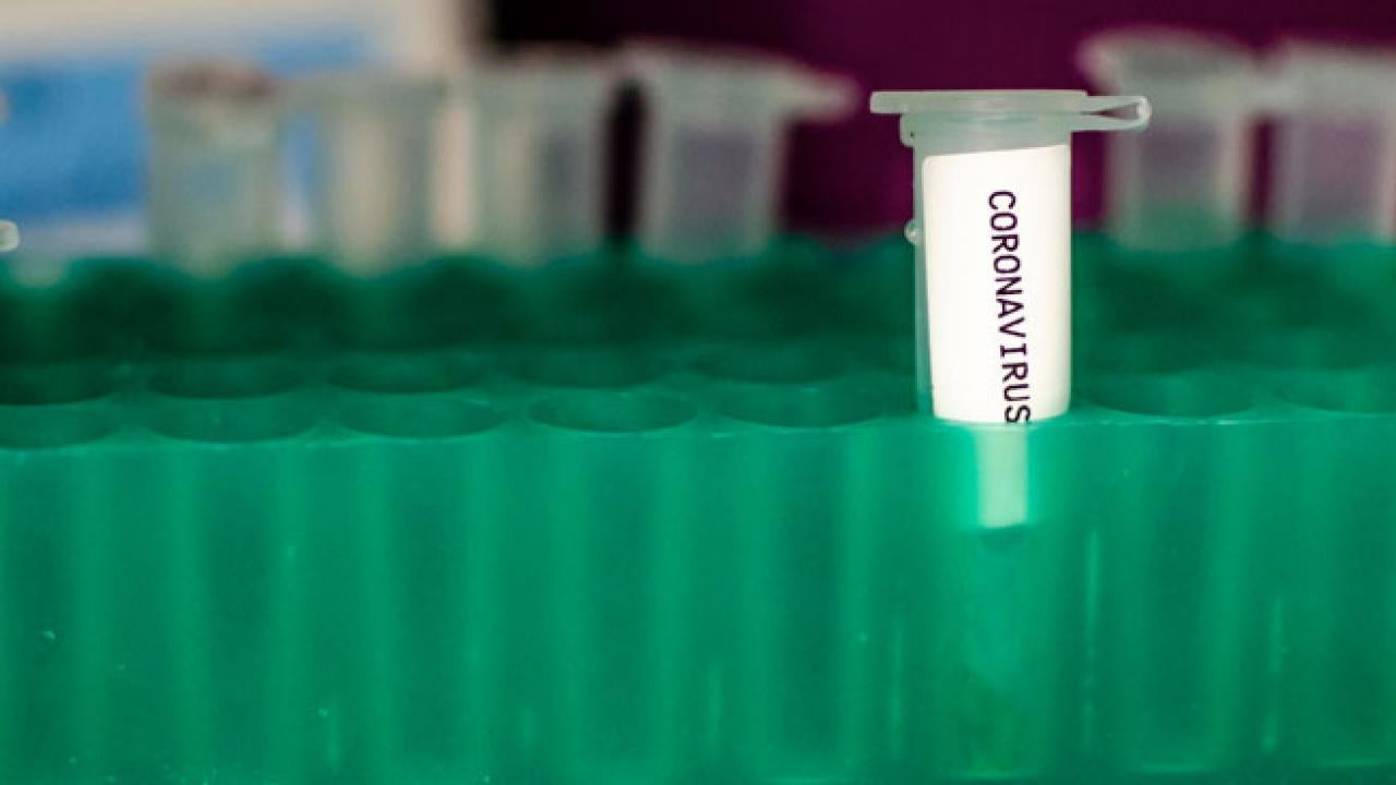 A vile of coronavirus lab results