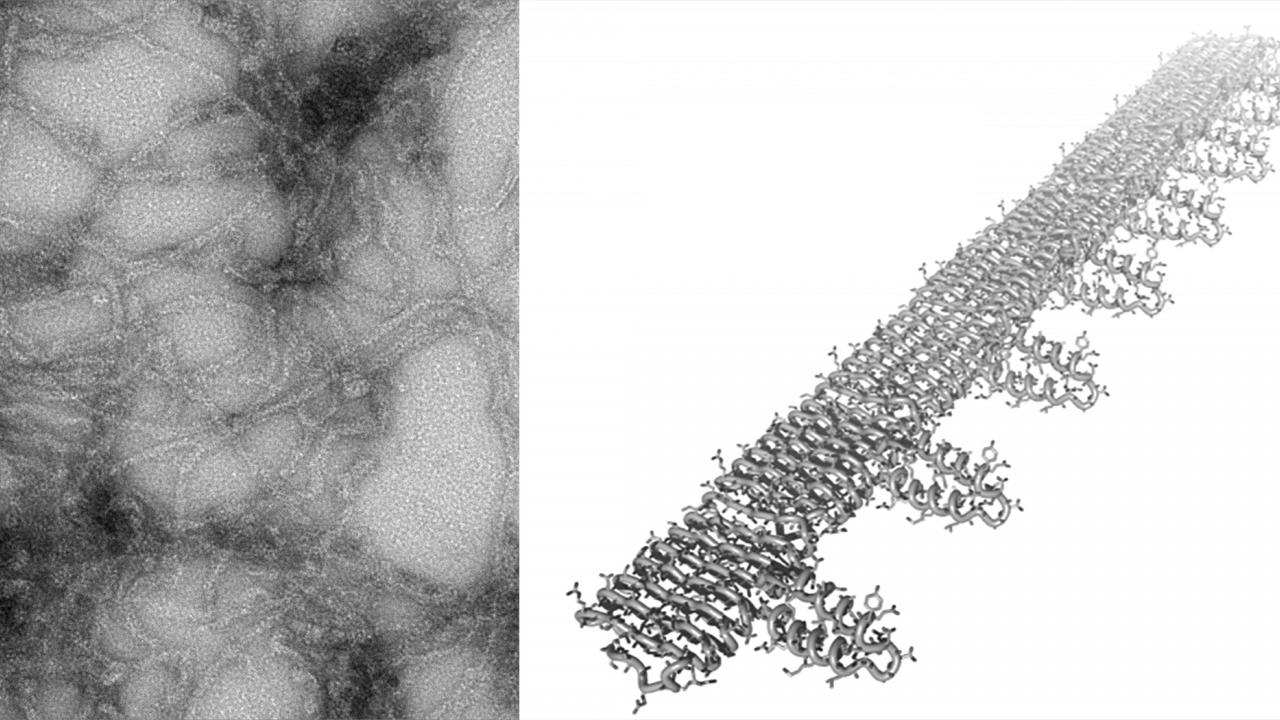 Composite of electron microscope image and rendering of fibrils. 