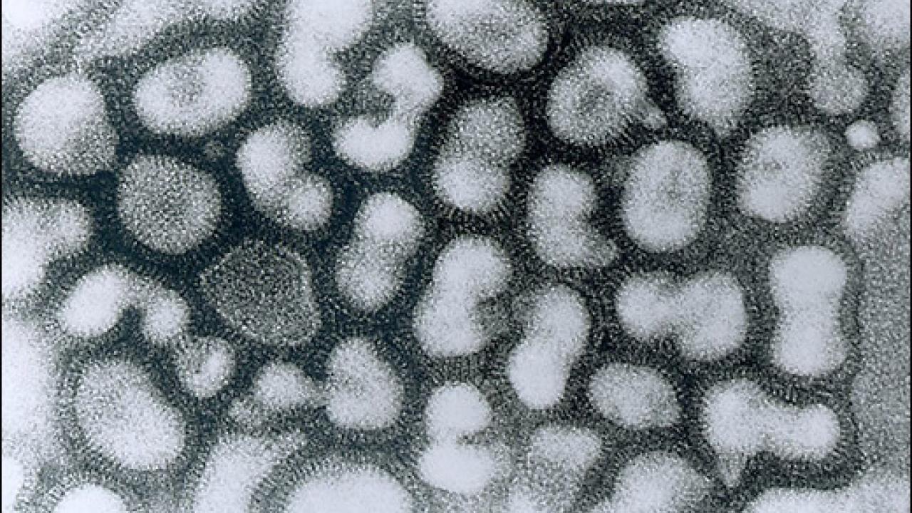 Electron micrograph photo of flu virus 