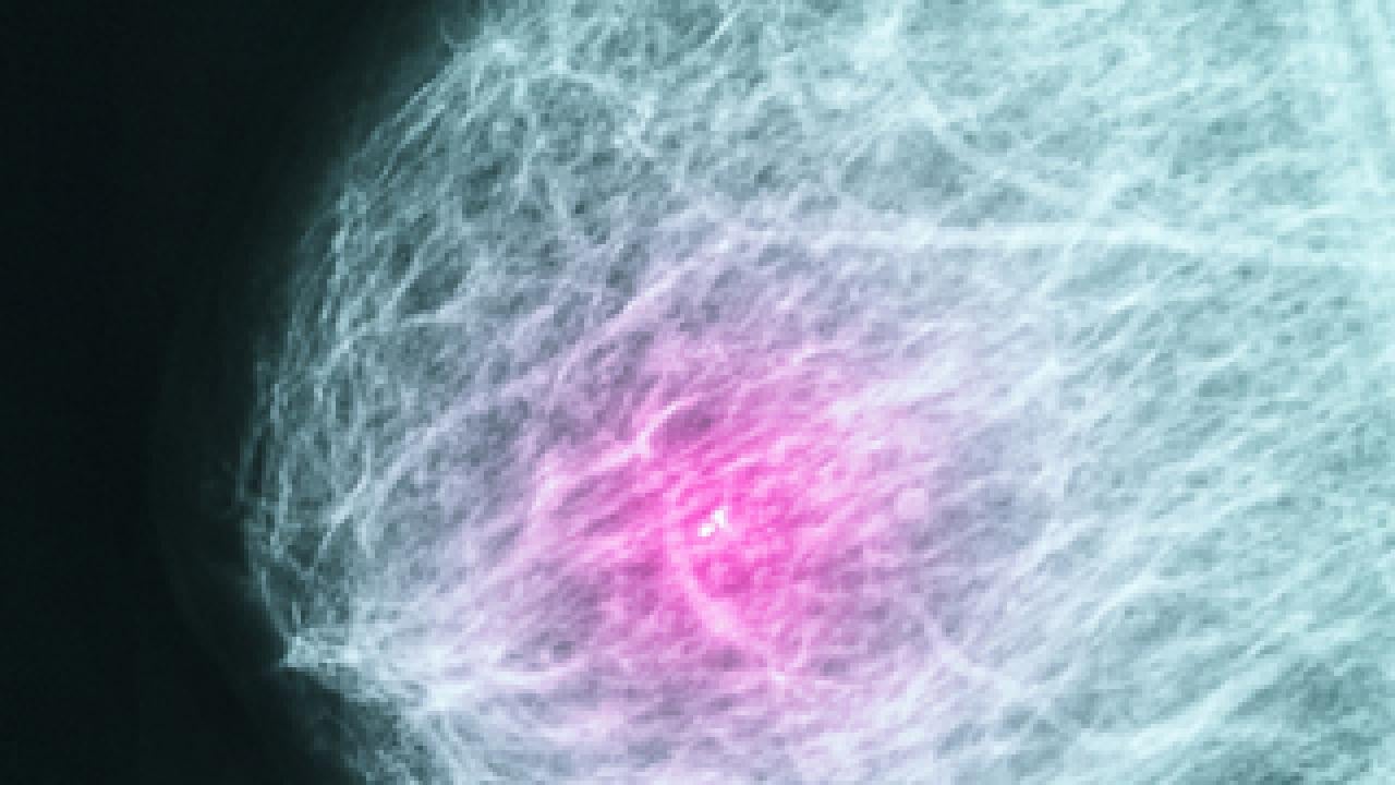 Mammogram of breast with pink spot