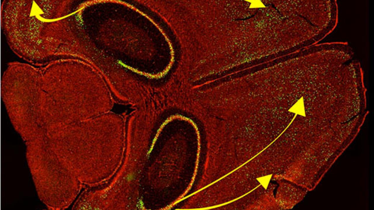 Mouse brain drawing with some yellow arrows on either side of the brain