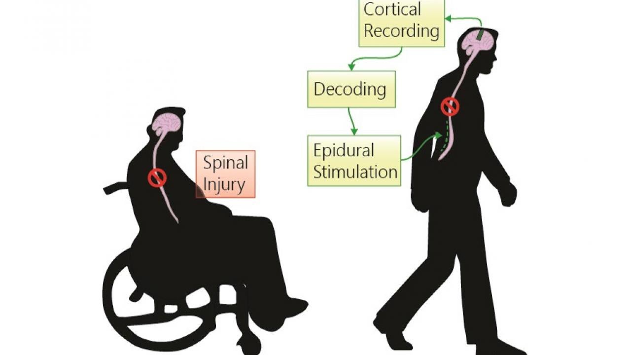 Graphic of treatment of spinal injury