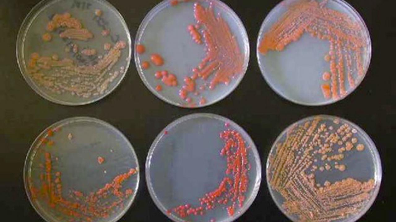 Photo: Yeast, in six Petri dishes