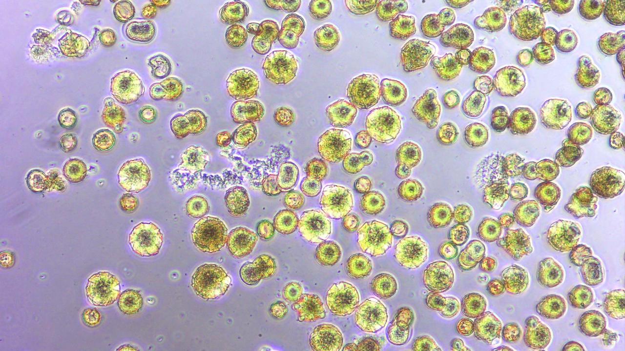 close up of Acinebactor, a bacteria common in flowers, interacting with pollen grains that are germinating and bursting