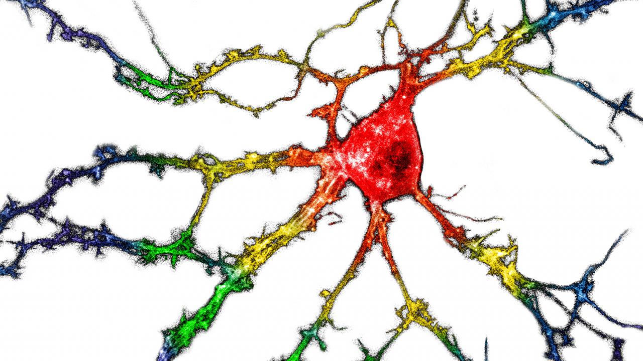 Graphic of colored neurons