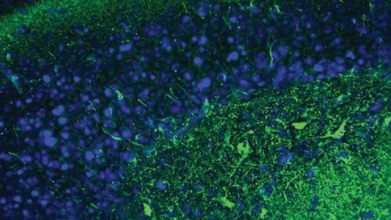 Graphic showing the brain's hippocampus stained in green to detect degenerating neurons. (UC Davis) 