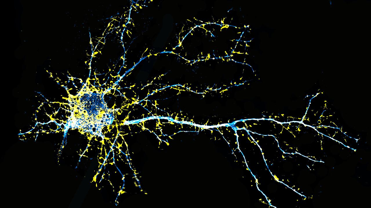 Researchers Develop an LSD Analogue with Potential for Treating