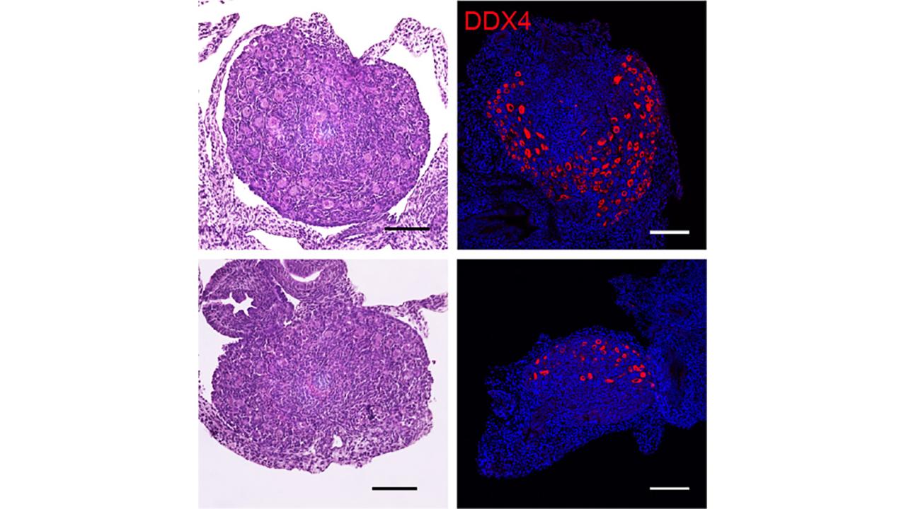 2 by 2 grid of four images: At left, two micrographs of dark pink tissue on white background. At left, dark blue images with red spots on black background. 