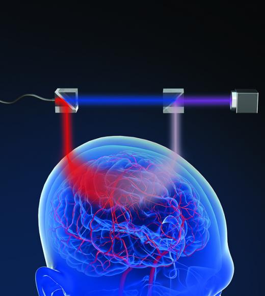 Graphic of device for measuring cerebral blood flow
