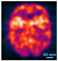 Colored image of a fake brain used for testing imaging technology