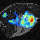 Image: scan of brain with colored spots