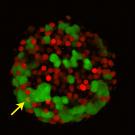 Pancreas islet with colored cells