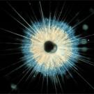 Living planktonic foraminifera, Globigerinoides ruber, from subtropical waters of the Atlantic. The central calcium carbonate shell is surrounded by symbiotic dinoflagellates (gold-color) and a rhizopodia-spine matrix. Fossil shells of this shor