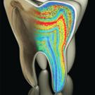 Graphic showing a tooth with various internal colored patterns