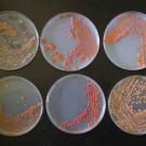 Photo: Yeast, in six Petri dishes