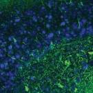 Graphic showing the brain's hippocampus stained in green to detect degenerating neurons