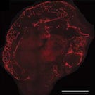 microscopic photography of an organoid growing blood vessels