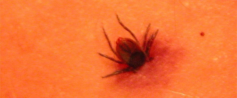 Tick going into human skin
